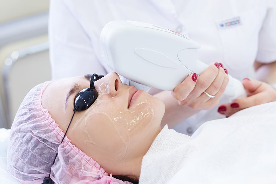 laser facial Janakpuri